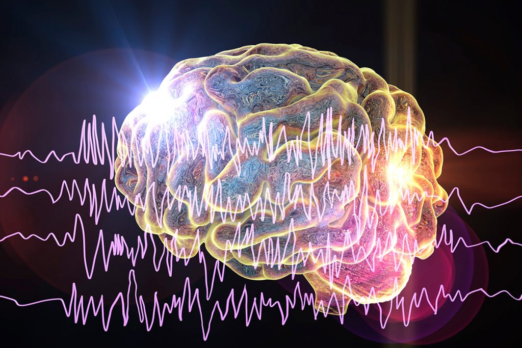 Epilepsija i fizička aktivnost